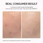 ARENCIA TXA Booster Shot Result Before and After Use